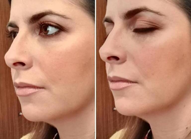 酒店 Pensione Villa Ida