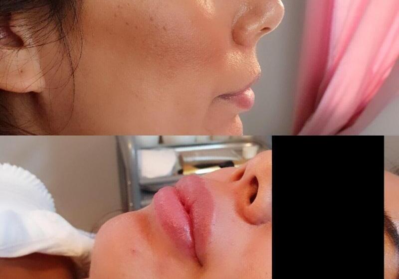 酒店 Lidingö Arena